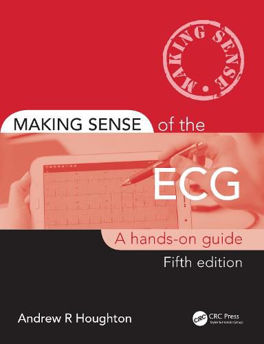 Making Sense of the ECG: A Hands-On Guide