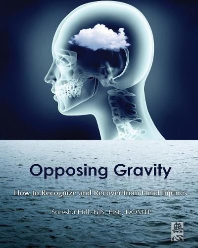 Cover image for Opposing Gravity: How to Recognize and Recover from Head Injuries