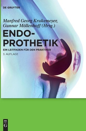 Cover image for Endoprothetik: Ein Leitfaden Fur Den Praktiker