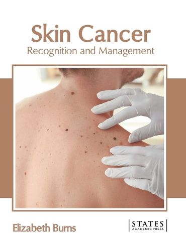 Skin Cancer: Recognition and Management