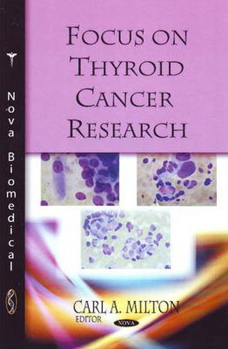 Cover image for Focus on Thyroid Cancer Research