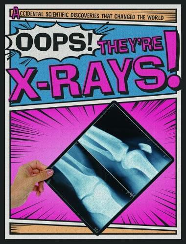 Cover image for Oops! They're X-Rays!