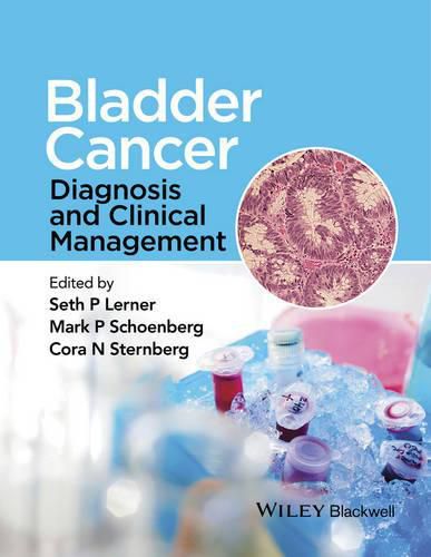 Cover image for Bladder Cancer: Diagnosis and Clinical Management