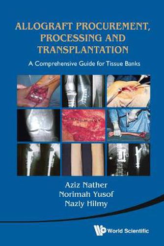 Cover image for Allograft Procurement, Processing And Transplantation: A Comprehensive Guide For Tissue Banks