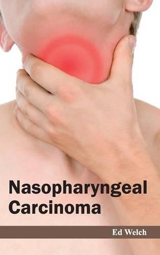 Cover image for Nasopharyngeal Carcinoma