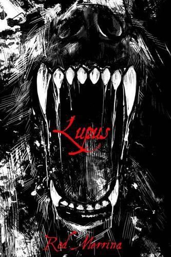 Cover image for Lupus