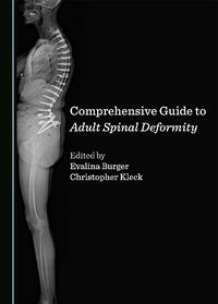 Cover image for Comprehensive Guide to Adult Spinal Deformity