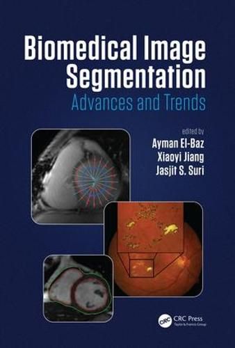 Cover image for Biomedical Image Segmentation: Advances and Trends