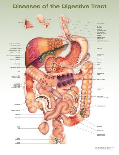 Cover image for Diseases of the Digestive Tract Anatomical Chart