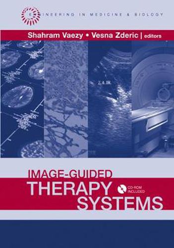 Cover image for Image-Guided Therapy Systems