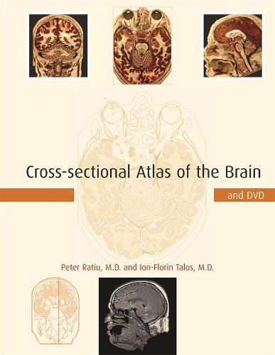 Cover image for Cross-sectional Atlas of the Brain and DVD