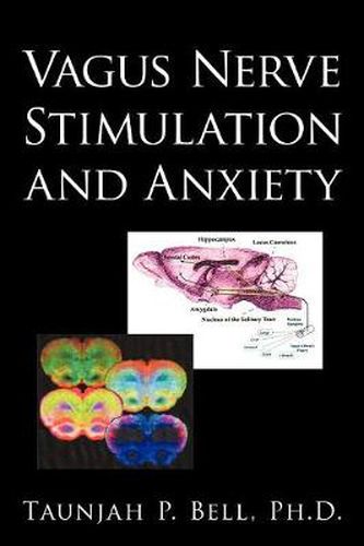 Cover image for Vagus Nerve Stimulation and Anxiety