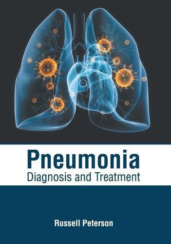 Cover image for Pneumonia: Diagnosis and Treatment