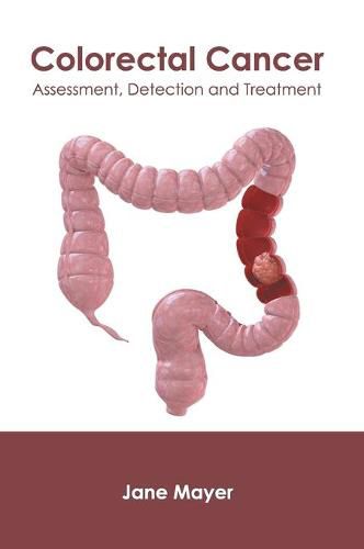 Colorectal Cancer: Assessment, Detection and Treatment