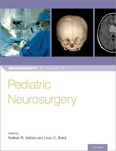 Cover image for Pediatric Neurosurgery