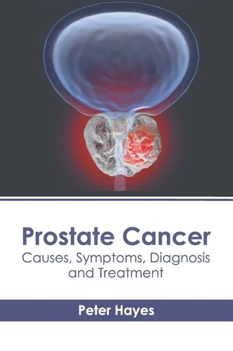 Prostate Cancer: Causes, Symptoms, Diagnosis and Treatment