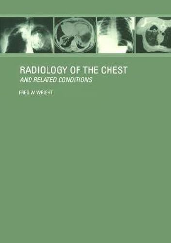 Radiology of the Chest and Related Conditions: Together with an extensive illustrative collection of radiographs, conventional and computed tomograms, isotope studies, MRs, etc.on CD-ROM. (Cross-platform for Mac and Windows version 3.1 or later)