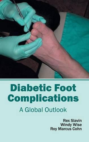 Cover image for Diabetic Foot Complications: A Global Outlook
