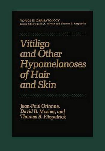 Cover image for Vitiligo and Other Hypomelanoses of Hair and Skin