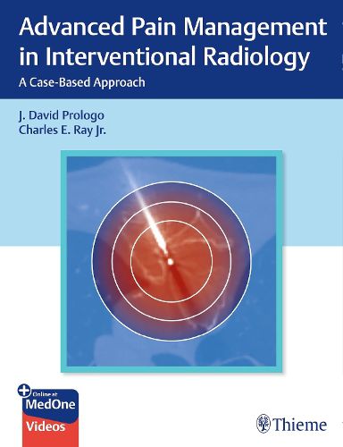 Cover image for Advanced Pain Management in Interventional Radiology
