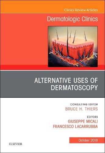 Cover image for Alternative Uses of Dermatoscopy, An Issue of Dermatologic Clinics