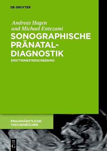 Cover image for Sonographische Pranataldiagnostik
