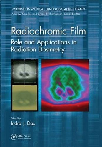 Cover image for Radiochromic Film: Role and Applications in Radiation Dosimetry