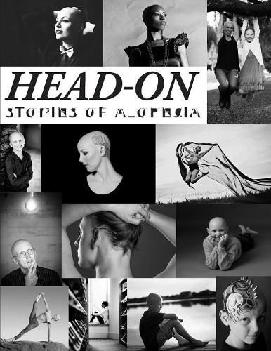 Cover image for Head-On, Stories of Alopecia