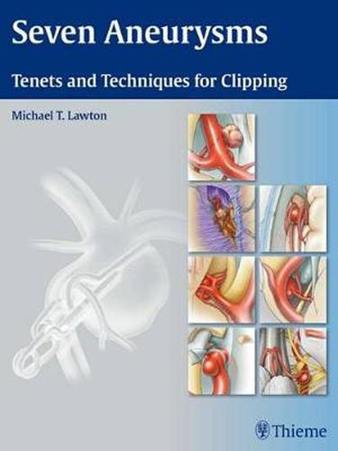 Cover image for Seven Aneurysms: Tenets and Techniques for Clipping