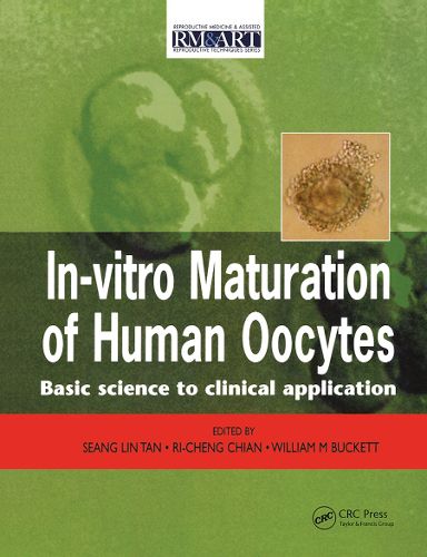 Cover image for In Vitro Maturation of Human Oocytes