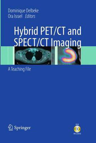 Cover image for Hybrid PET/CT and SPECT/CT Imaging: A Teaching File