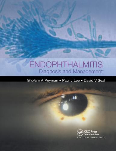 Cover image for Endophthalmitis: Diagnosis and Treatment