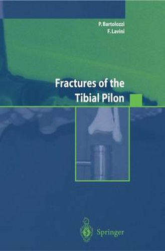 Cover image for Fractures of the Tibial Pilon