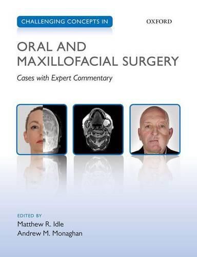 Cover image for Challenging Concepts in Oral and Maxillofacial Surgery: Cases with Expert Commentary