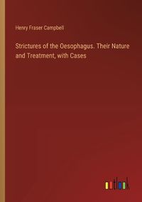 Cover image for Strictures of the Oesophagus. Their Nature and Treatment, with Cases