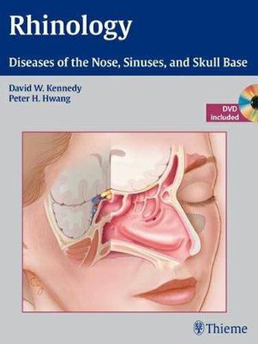 Rhinology: Diseases of the Nose, Sinuses, and Skull Base