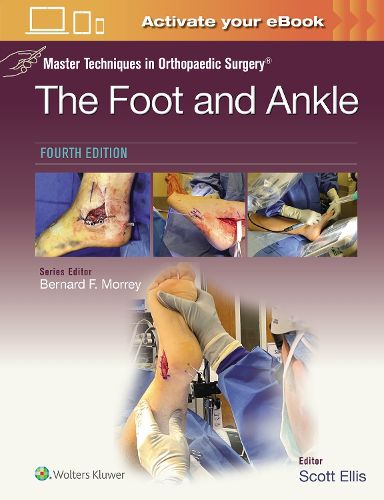 Cover image for Master Techniques in Orthopaedic Surgery: The Foot and Ankle: Print + eBook with Multimedia