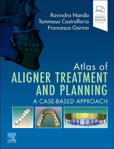 Cover image for Atlas of Aligner Treatment and Planning