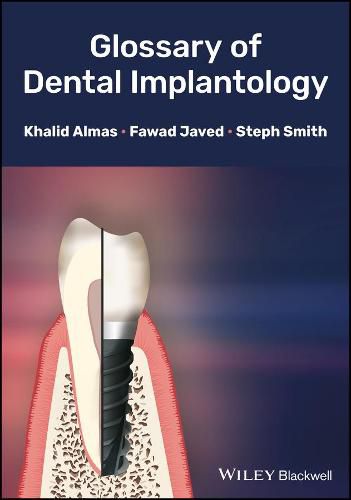 Cover image for Glossary of Dental Implantology