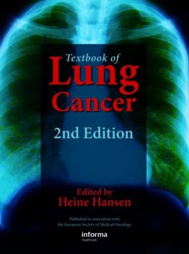 Cover image for Textbook of Lung Cancer
