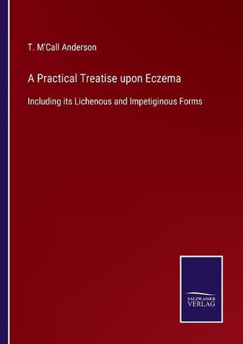 Cover image for A Practical Treatise upon Eczema: Including its Lichenous and Impetiginous Forms