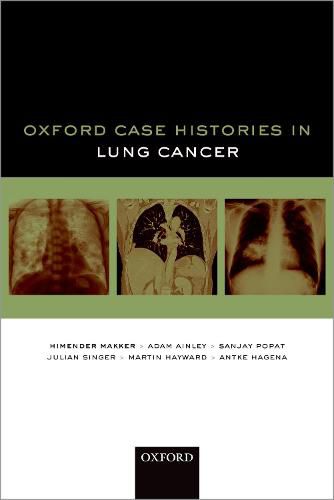 Cover image for Oxford Case Histories in Lung Cancer