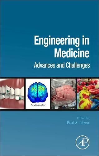 Cover image for Engineering in Medicine: Advances and Challenges