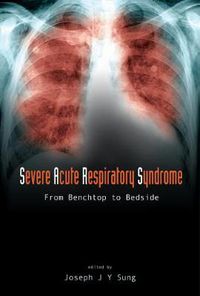 Cover image for Severe Acute Respiratory Syndrome (Sars): From Benchtop To Bedside
