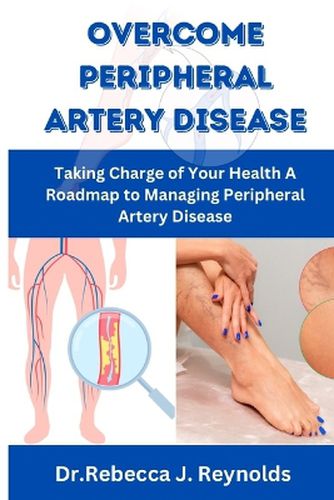 Overcome Peripheral Artery Disease