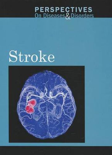 Cover image for Stroke