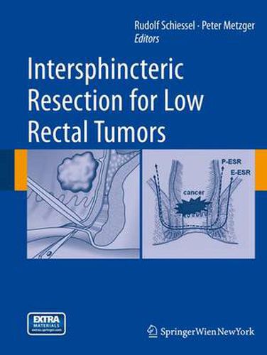 Cover image for Intersphincteric Resection for Low Rectal Tumors