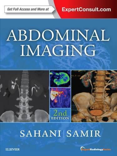 Cover image for Abdominal Imaging: Expert Radiology Series