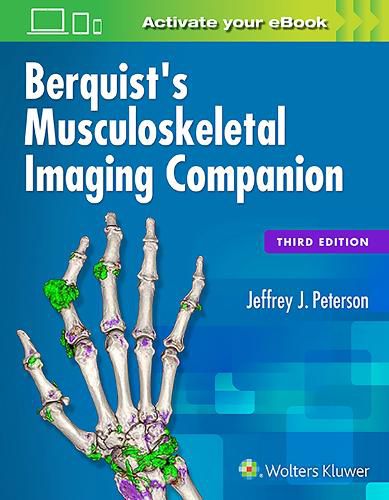 Cover image for Berquist's Musculoskeletal Imaging Companion