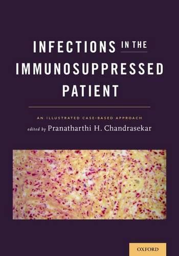 Cover image for Infections in the Immunosuppressed Patient: An Illustrated Case-Based Approach